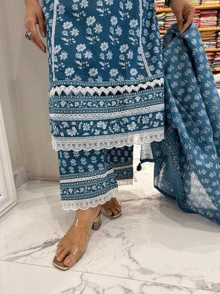 Forever Lace Set - Preetibora
